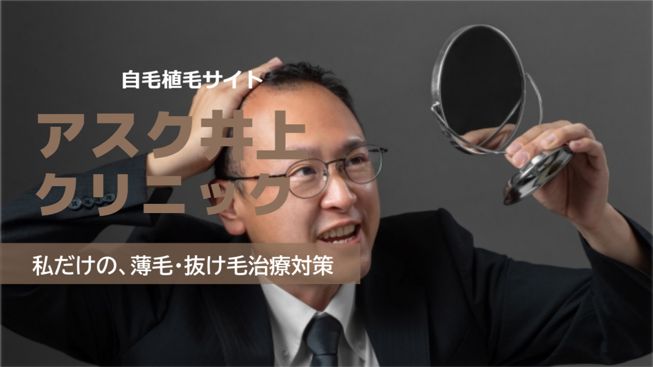 アスク井上クリニックの口コミは?効果なしは嘘?気になる自毛植毛の料金と本当の評判を徹底調査!