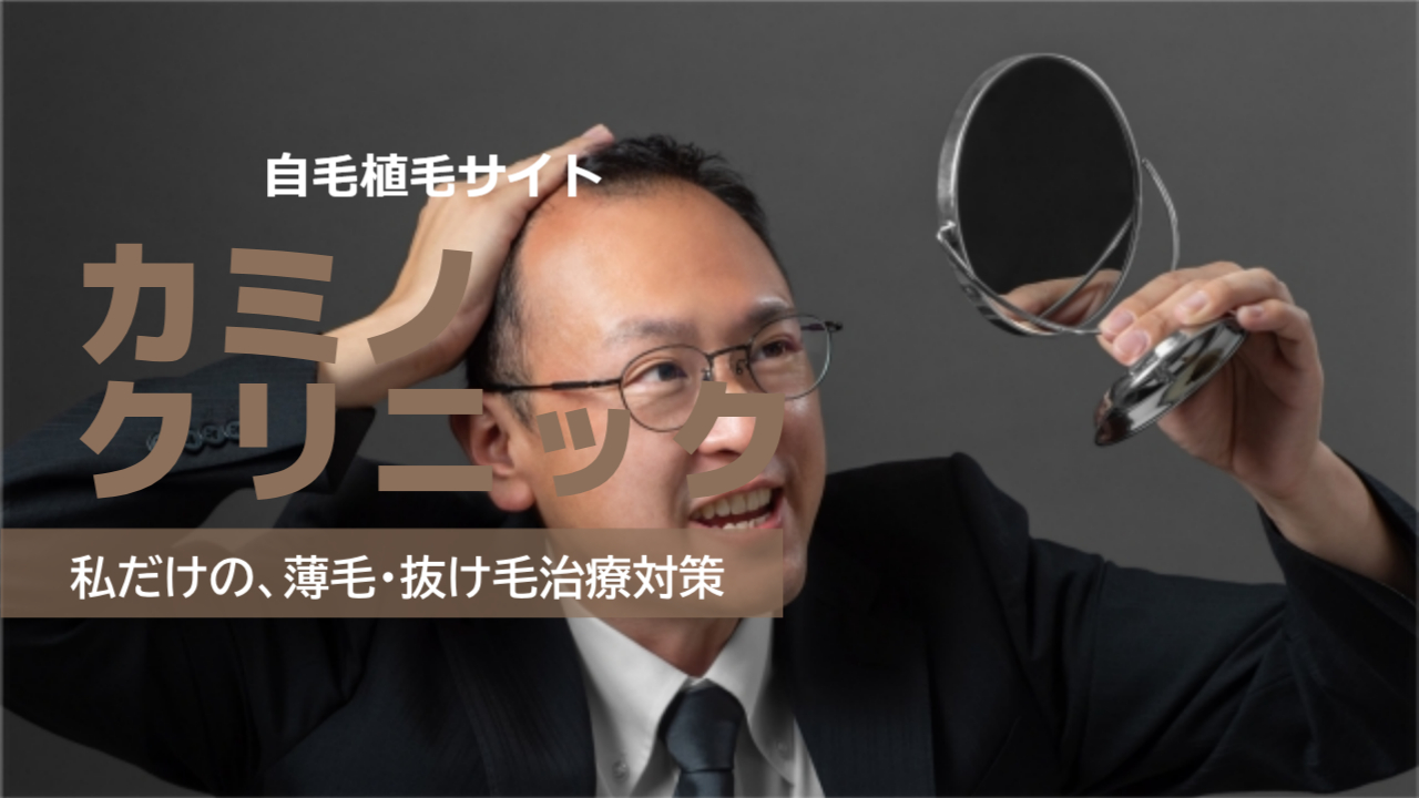 カミノクリニック（旧：ニューエイジクリニック）の植毛の口コミは？効果なしは嘘？気になる自毛植毛の料金と本当の評判を徹底調査！