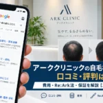アーククリニックの自毛植毛に関する口コミ・評判は?費用・Re:Ark法・保証を解説【2026年最新】