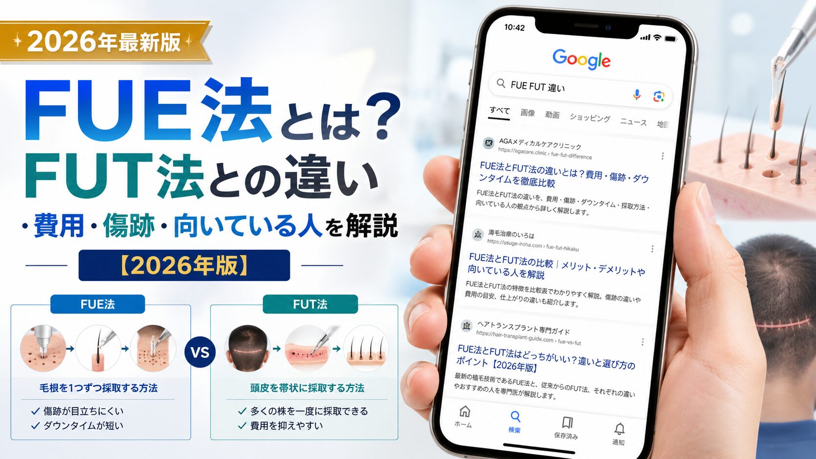 FUE法とは?FUT法との違い・費用・傷跡・向いている人を解説【2026年7月最新】