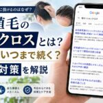 自毛植毛のショックロスとは?いつからいつまで続く?原因と対策を解説【2026年6月最新】