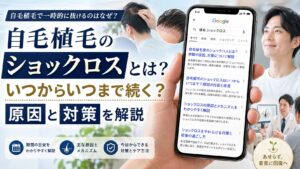 自毛植毛のショックロスとは？いつからいつまで続く？原因と対策を解説【2026年6月最新】