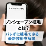 ノンシェーブン植毛とは？バレずに植毛できる最新技術を解説