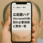 広範囲ハゲ（Norwood分類）別の必要株数と費用一覧