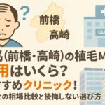 群馬（前橋・高崎）の植毛m字ハゲ費用とおすすめクリニック！東京との相場比較と後悔しない選び方