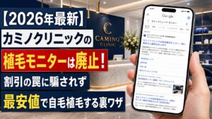カミノクリニックの植毛モニターは廃止！割引の罠に騙されず最安値で自毛植毛する裏ワザ【2026年最新】