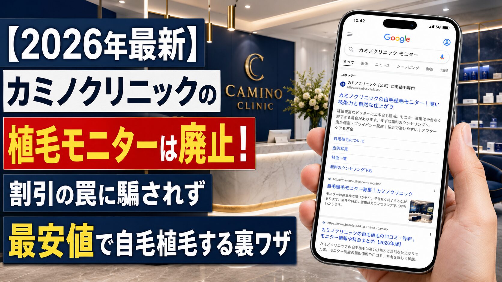 【2026年最新】カミノクリニックの植毛モニターは廃止！割引の罠に騙されず最安値で自毛植毛する裏ワザ