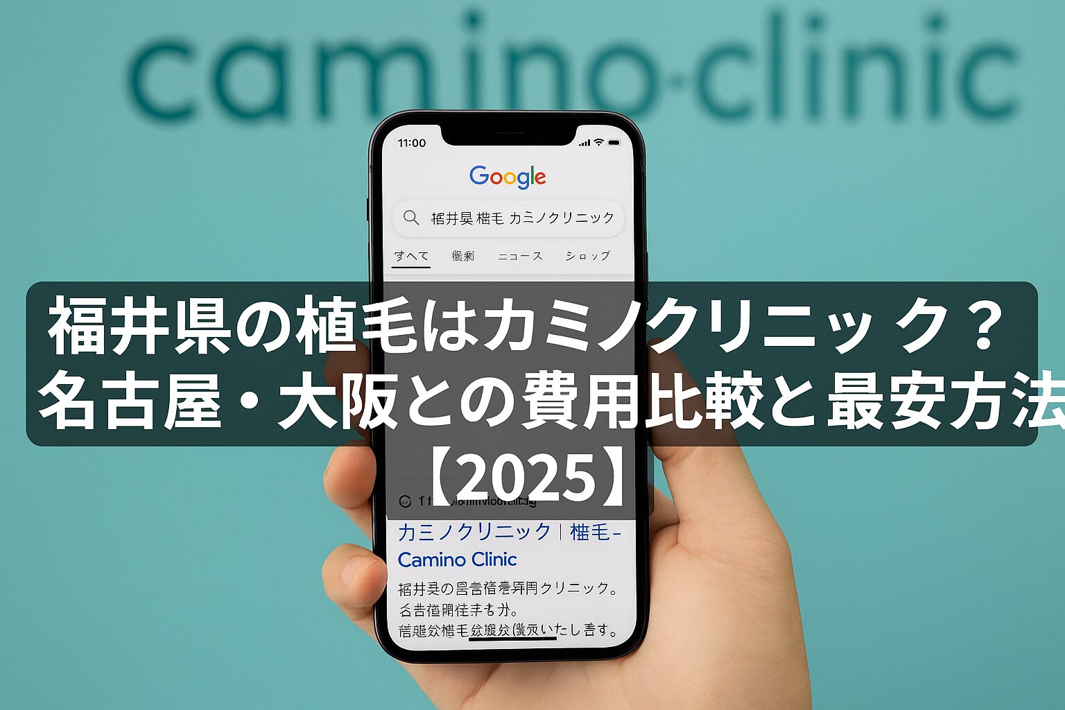 福井県の植毛はカミノクリニック？名古屋・大阪との費用比較と最安方法【2026】