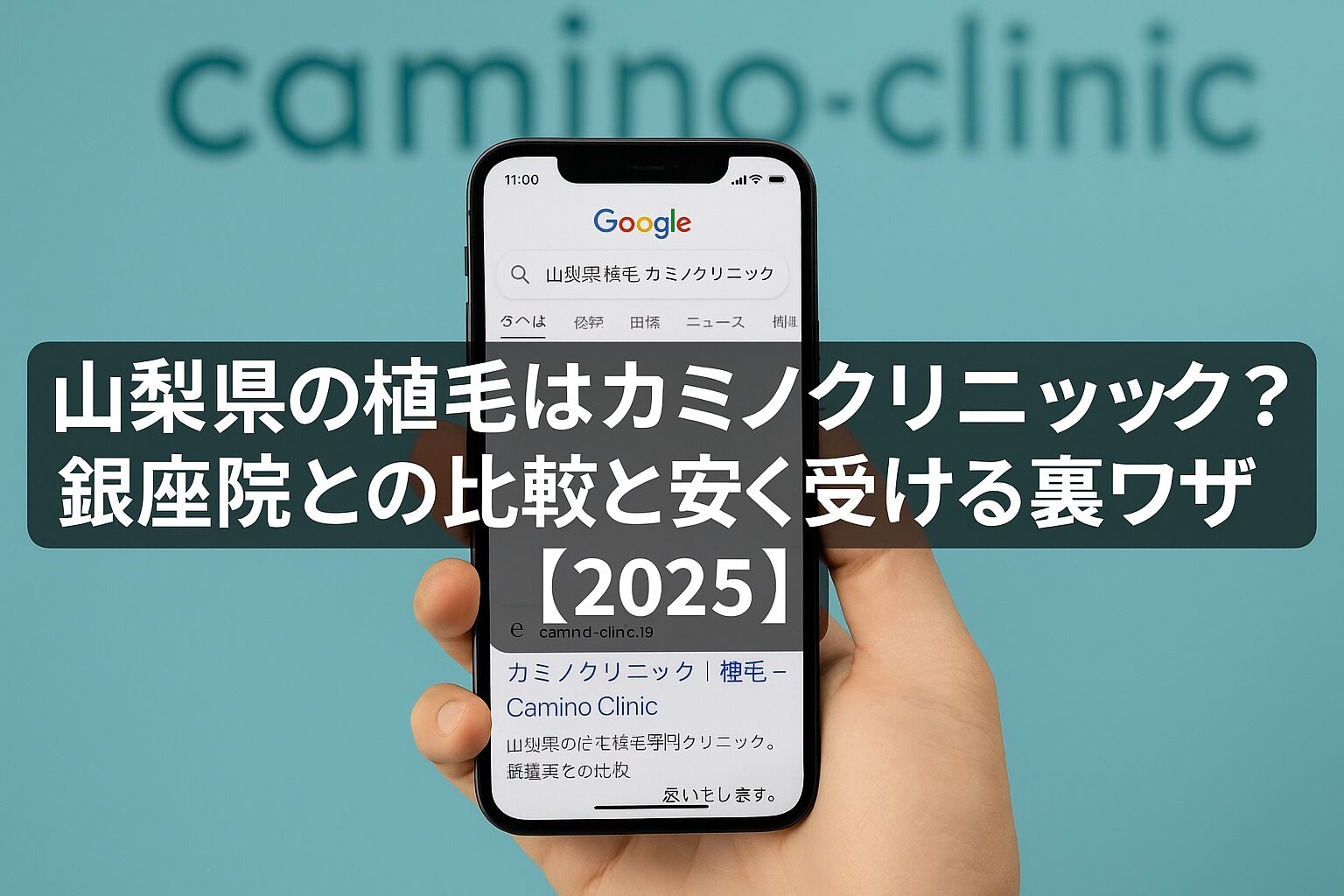 山梨県の植毛はカミノクリニック？銀座院との比較と安く受ける裏ワザ【2026】