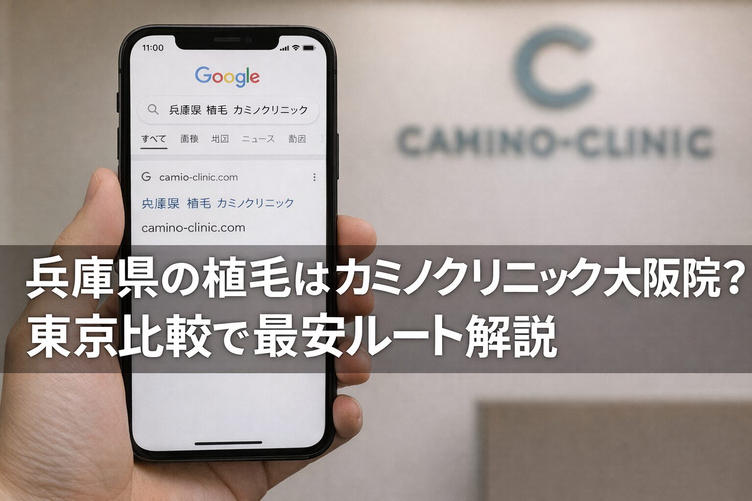 兵庫県の植毛はカミノクリニック大阪院？東京比較で最安ルート解説【2026】