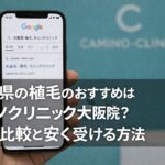 奈良県の植毛のおすすめはカミノクリニック大阪院？費用比較と安く受ける方法【2026】