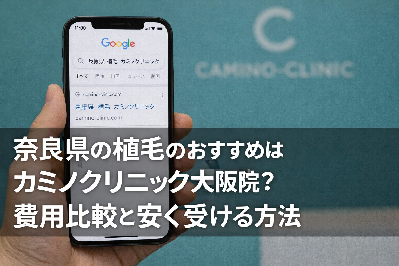 奈良県の植毛のおすすめはカミノクリニック大阪院？費用比較と安く受ける方法【2026】