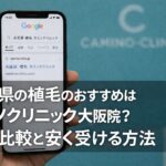 鳥取県の植毛のおすすめはカミノクリニック？大阪・福岡との比較と安く受ける方法【2026】