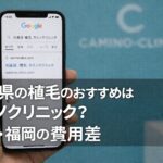 島根県の植毛のおすすめはカミノクリニック？大阪・福岡の費用差【2026】