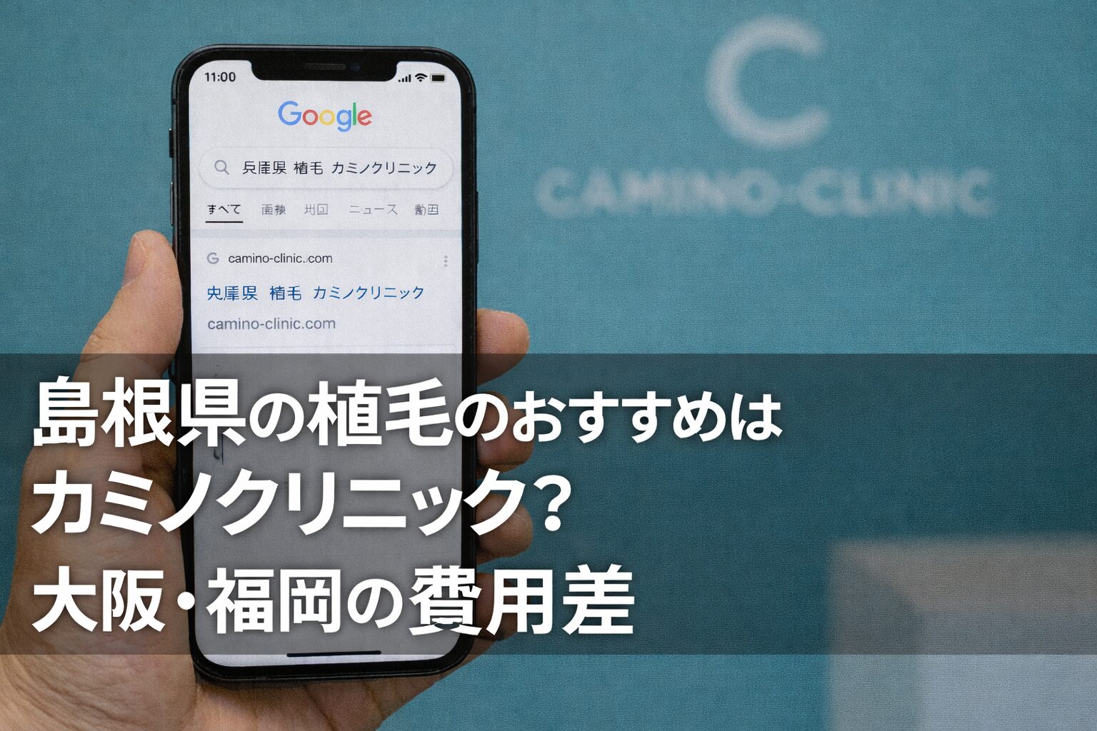 島根県の植毛のおすすめはカミノクリニック？大阪・福岡の費用差【2026】
