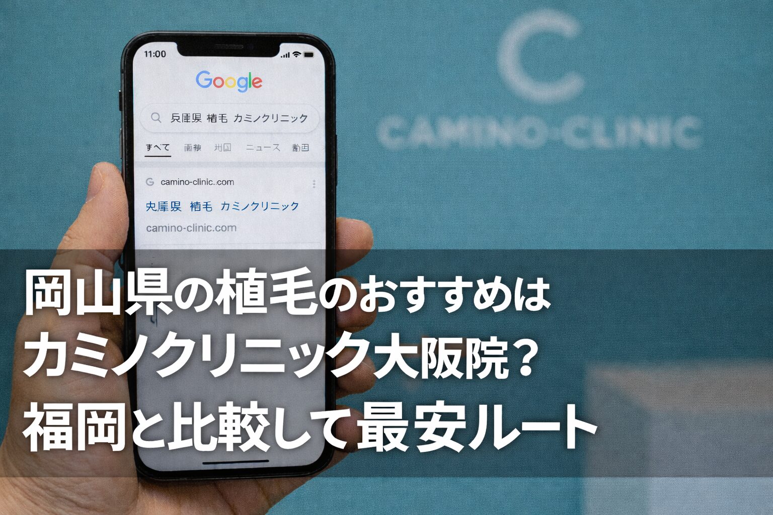 岡山県の植毛のおすすめはカミノクリニック大阪院？福岡と比較して最安ルート【2026】