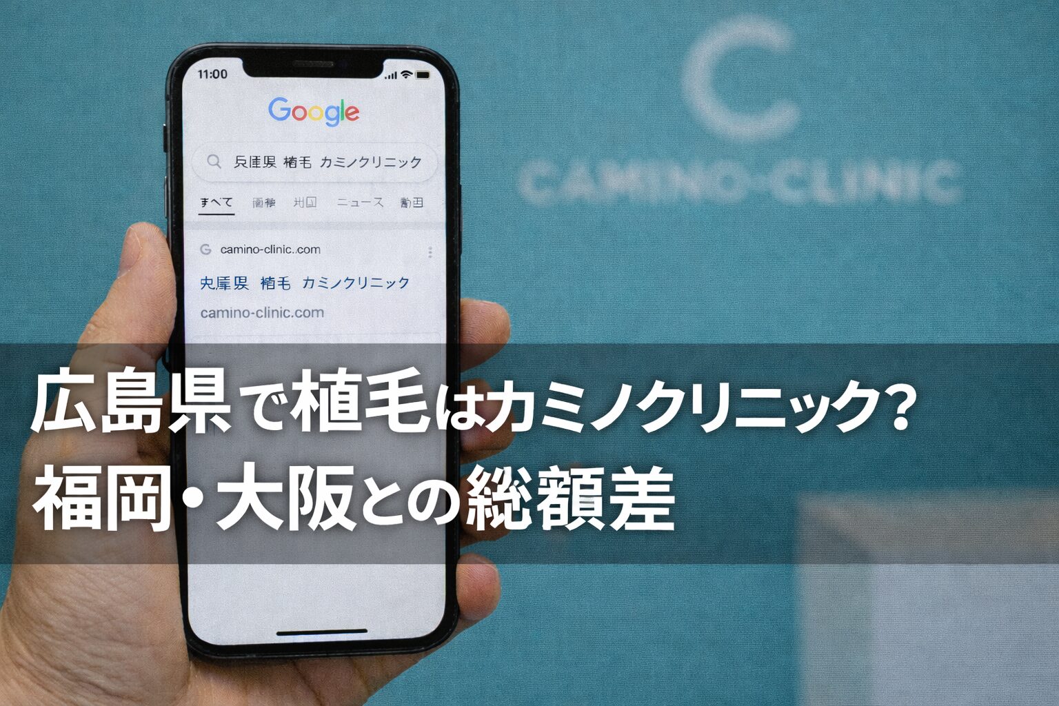 広島県で植毛はカミノクリニック？福岡・大阪との総額差【2026】