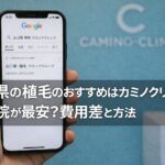 山口県の植毛のおすすめはカミノクリニック？福岡院が最安？費用差と方法【2026】