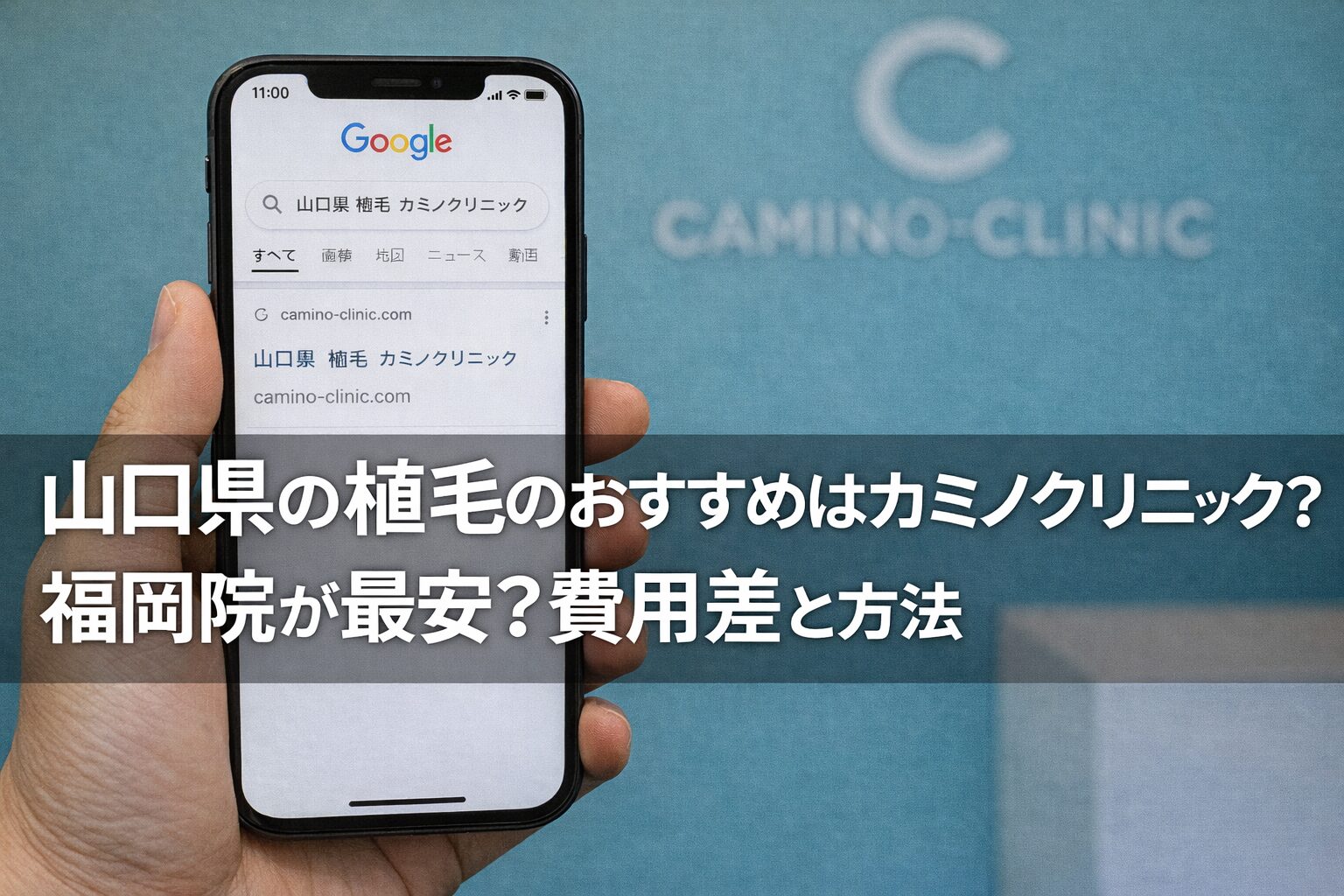 山口県の植毛のおすすめはカミノクリニック？福岡院が最安？費用差と方法【2026】
