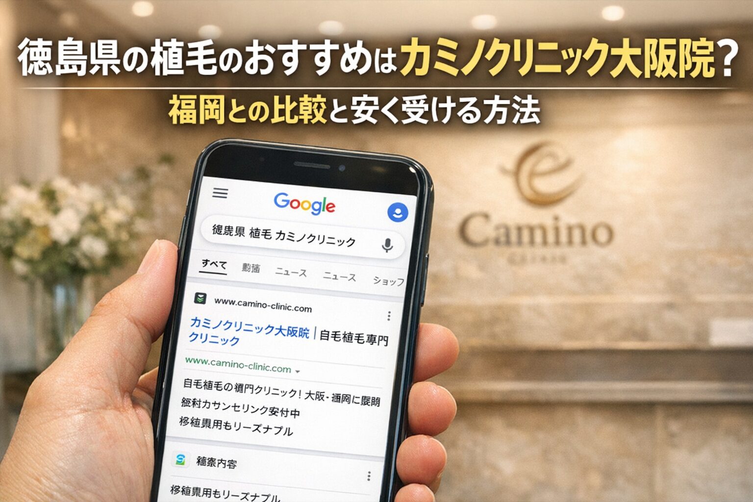 徳島県の植毛のおすすめはカミノクリニック大阪院?福岡との比較と安く受ける方法【2026】
