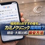 福岡県のおすすめ植毛はカミノクリニック福岡院？銀座・大阪比較と最安方法【2026】