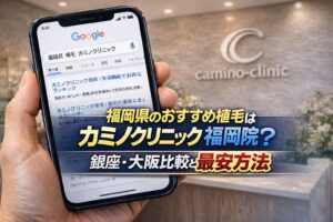 福岡県のおすすめ植毛はカミノクリニック福岡院？銀座・大阪比較と最安方法【2026】