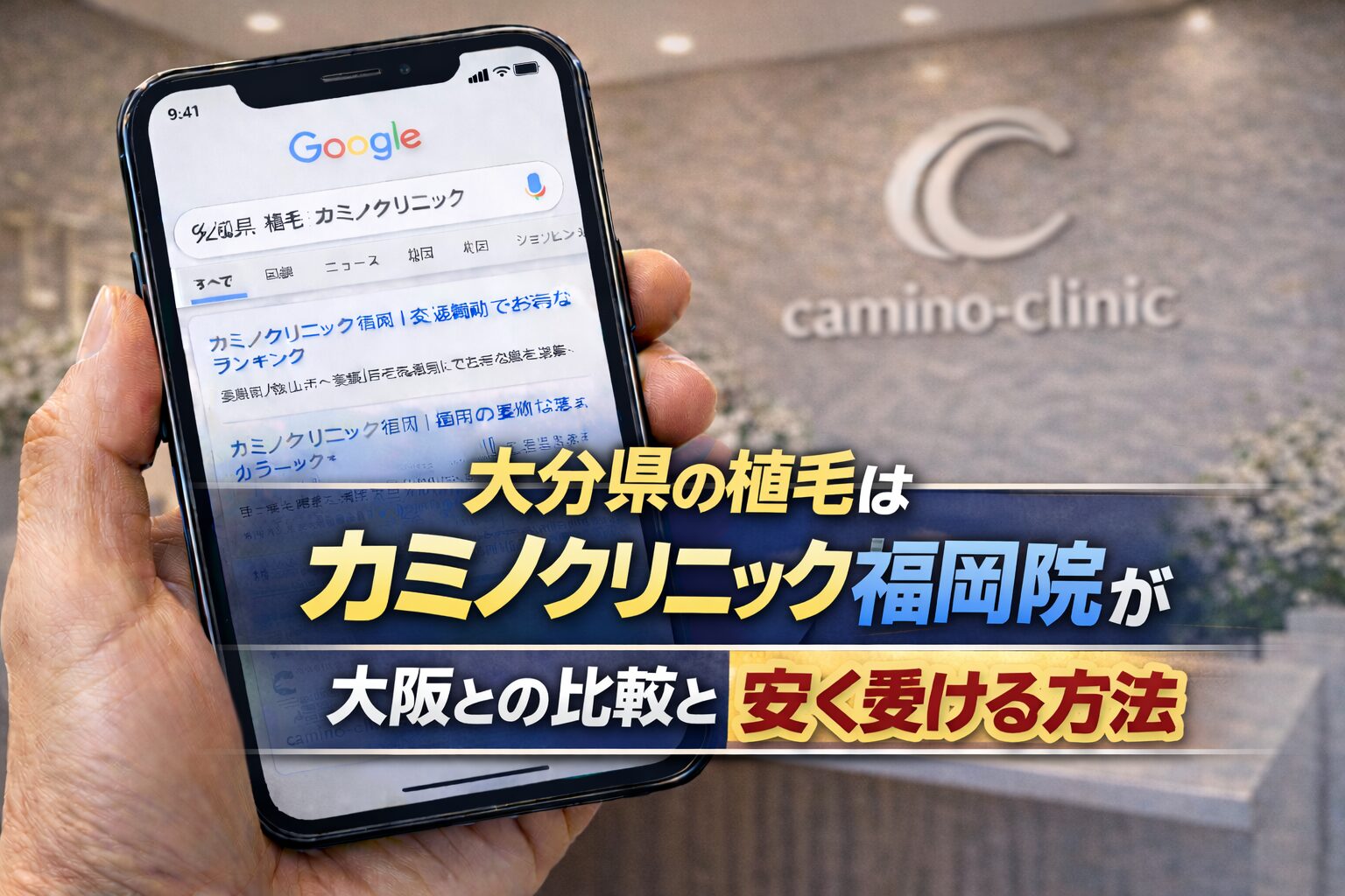 大分県の植毛はカミノクリニック福岡院?大阪との比較と安く受ける方法【2026】