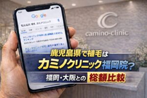 鹿児島県で植毛はカミノクリニック？福岡・大阪との総額比較【2026】