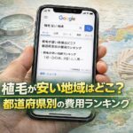 植毛が安い地域はどこ？都道府県別の費用ランキング【2026】