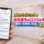 カミノクリニックの自毛植毛の口コミは本当？費用・失敗例・経過を30秒検証