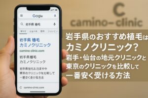 岩手県のおすすめ植毛はカミノクリニック？岩手・仙台の地元クリニックと東京のクリニックを比較して一番安く受ける方法【2025】