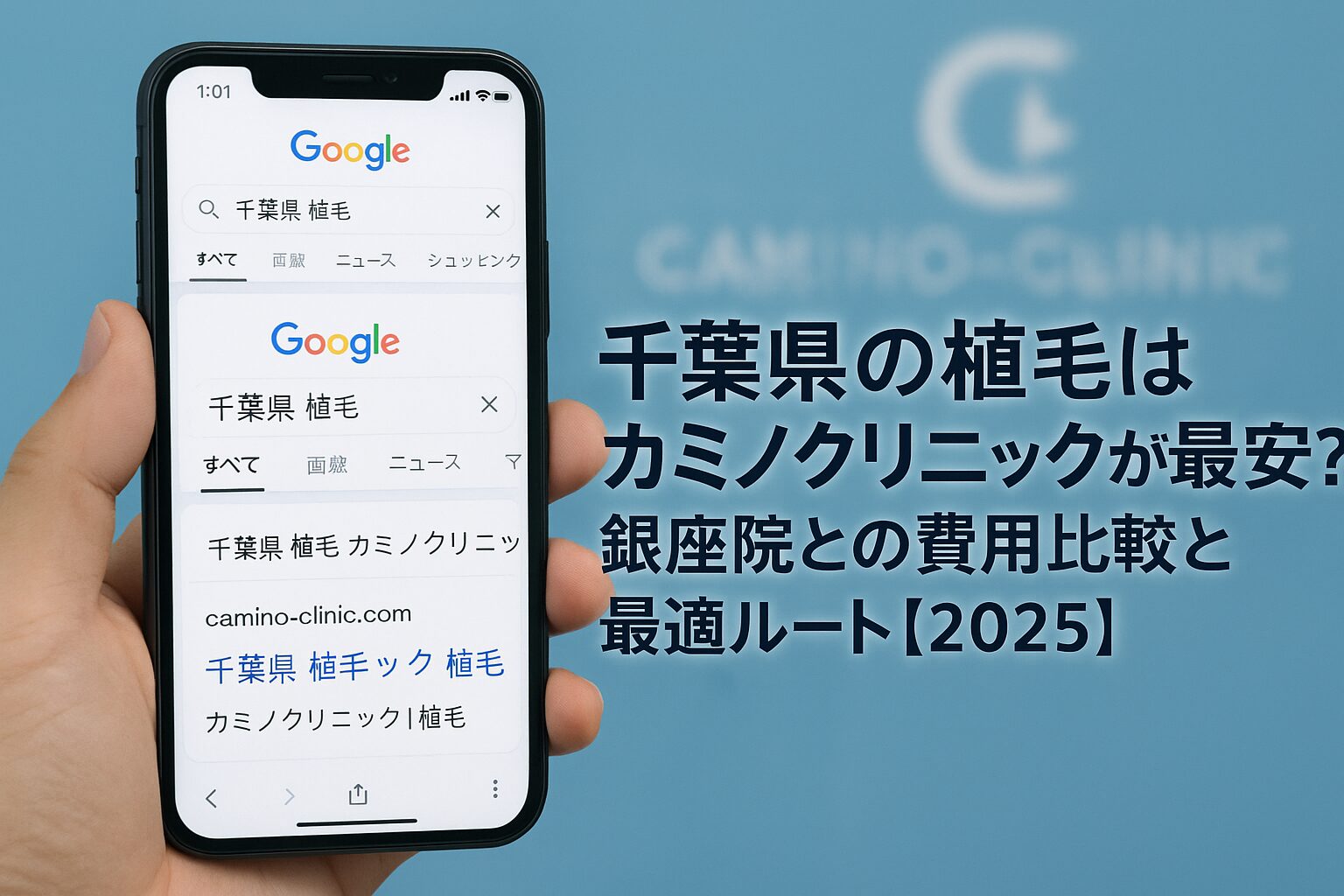 千葉県の植毛はカミノクリニックが最安?銀座院との費用比較と最適ルート【2025】