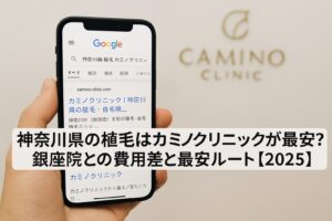 神奈川県の植毛はカミノクリニックが最安?銀座院との費用差と最安ルート【2025】