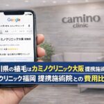 香川県の植毛はカミノクリニック大阪 提携施術院？カミノクリニック福岡 提携施術院との費用比較【2026】