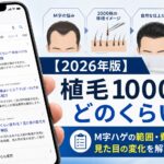 【2026年版】植毛1000株はどのくらい？M字ハゲの範囲・費用相場・見た目の変化を解説