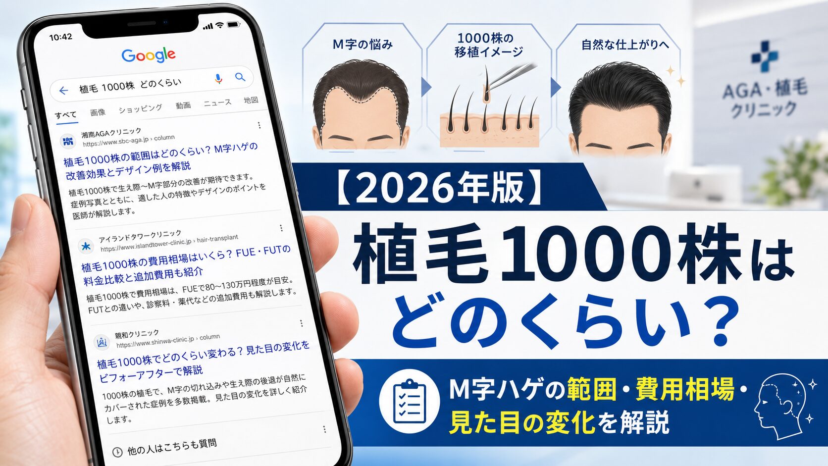 【2026年版】植毛1000株はどのくらい?M字ハゲの範囲・費用相場・見た目の変化を解説