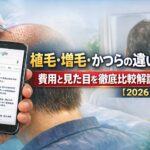 植毛・増毛・かつらの違いは?費用と見た目を徹底比較解説【2026】