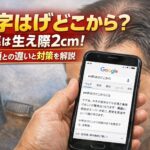 m字はげどこから?基準は生え際2cm!富士額との違いと対策を解説