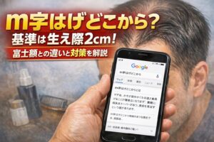 m字はげどこから？基準は生え際2cm！富士額との違いと対策を解説