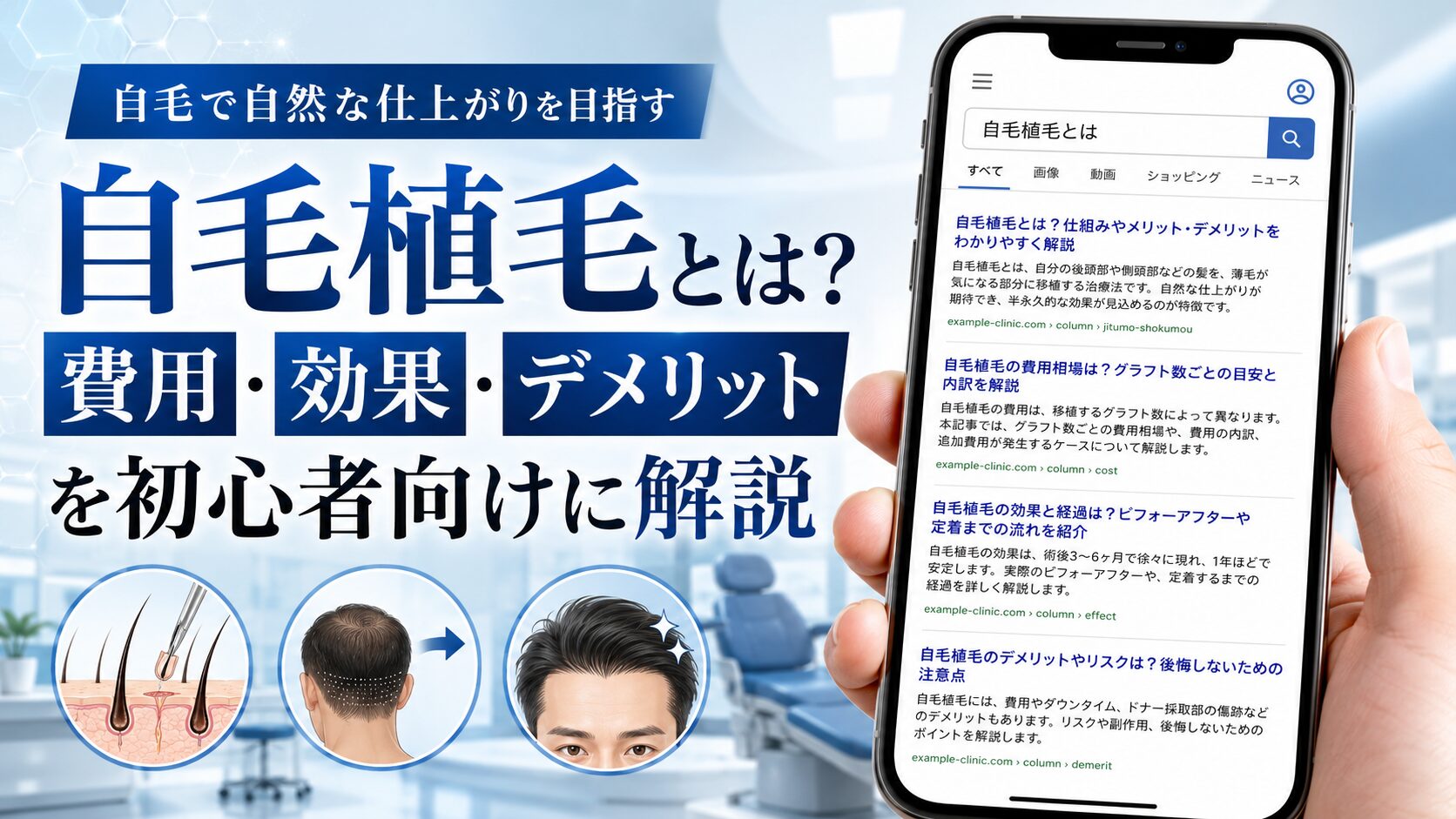 【2026年6月最新】自毛植毛とは？費用・効果・デメリットを初心者向けに解説