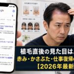 植毛直後の見た目はバレる？赤み・かさぶた・仕事復帰の目安を解説【2026年6月最新】