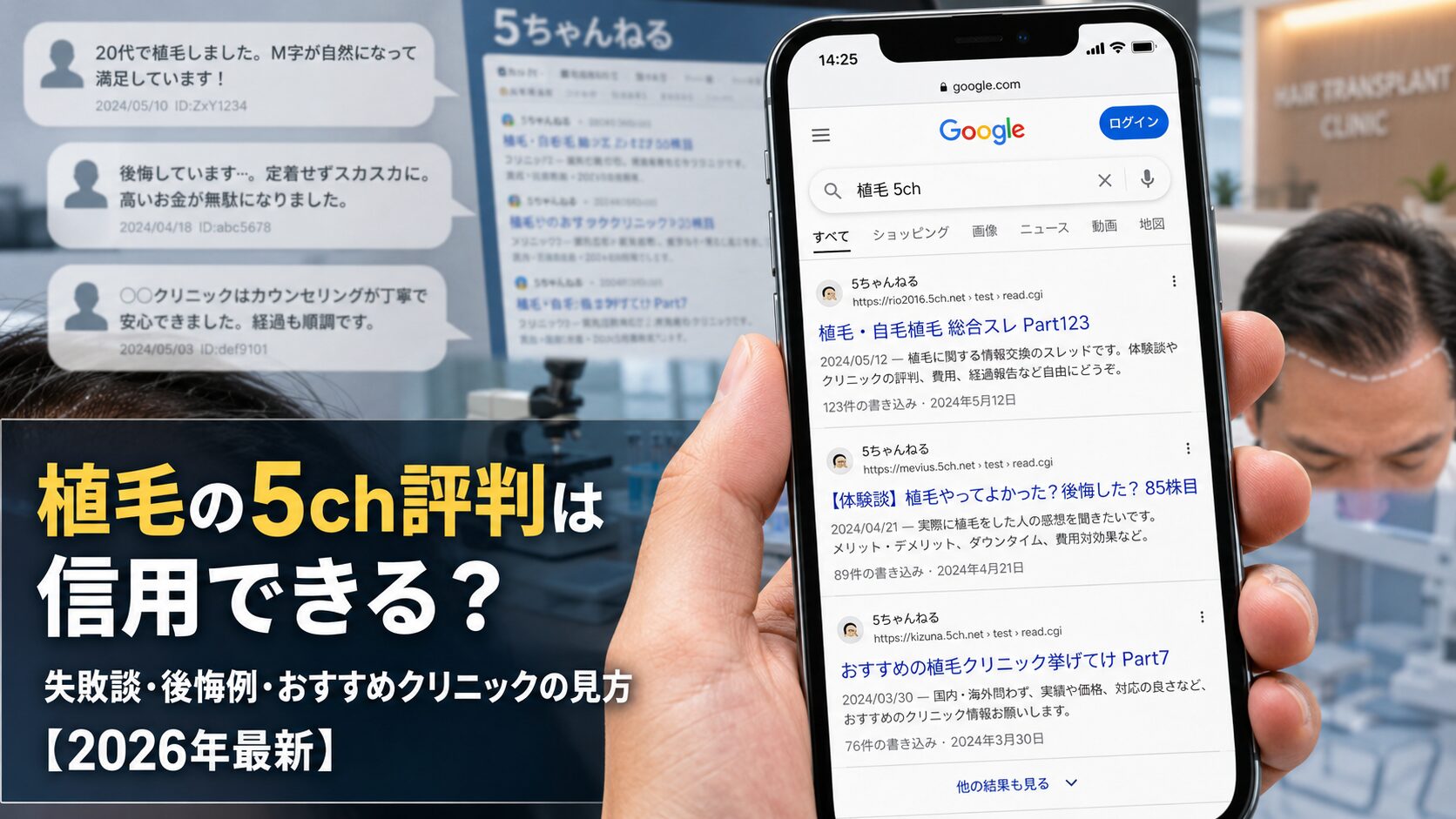 自毛植毛の5ch評判は信用できる？失敗談・後悔例・おすすめクリニックの見方【2026年6月最新】