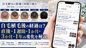 自毛植毛後の経過は？直後・1週間・1か月・3か月・1年の変化を解説【2026年6月最新】