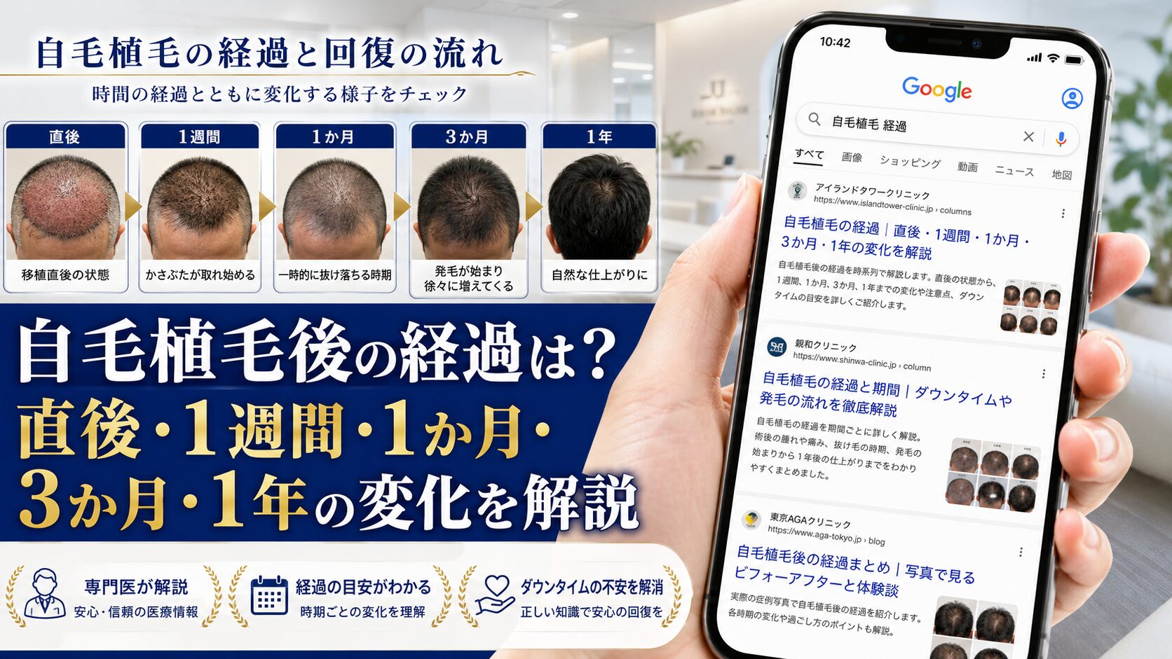 自毛植毛後の経過は？直後・1週間・1か月・3か月・1年の変化を解説【2026年6月最新】