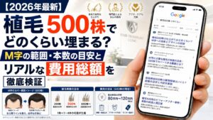 【2026年最新】植毛500株でどのくらい埋まる？M字の範囲・本数の目安とリアルな費用総額を徹底検証