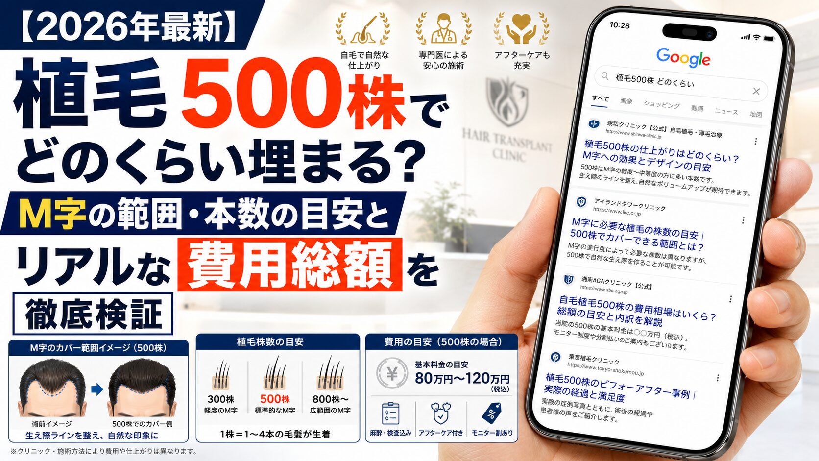 【2026年最新】植毛500株でどのくらい埋まる？M字の範囲・本数の目安とリアルな費用総額を徹底検証