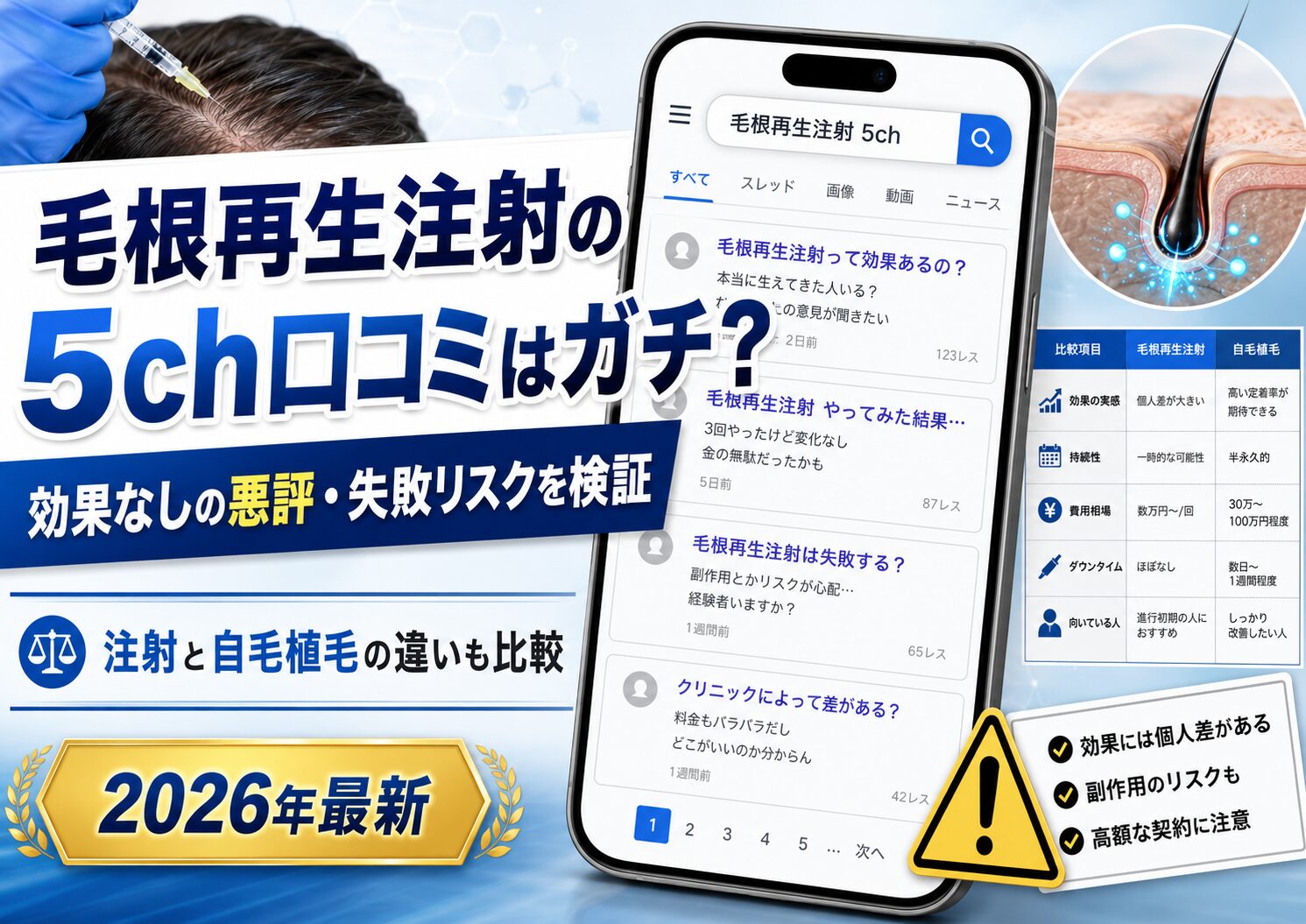 毛根再生注射の5ch(2ch)口コミはガチ?効果なしの悪評と失敗リスクの真実を徹底検証【2026年最新】