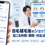 自毛植毛後のショックロスとは？起こる時期・期間・対処法【2026年最新】