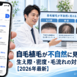 自毛植毛が不自然に見える原因｜生え際・密度・毛流れの対策【2026年最新】