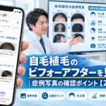 自毛植毛のビフォーアフターを見る方法|症例写真の確認ポイント【2026年最新】